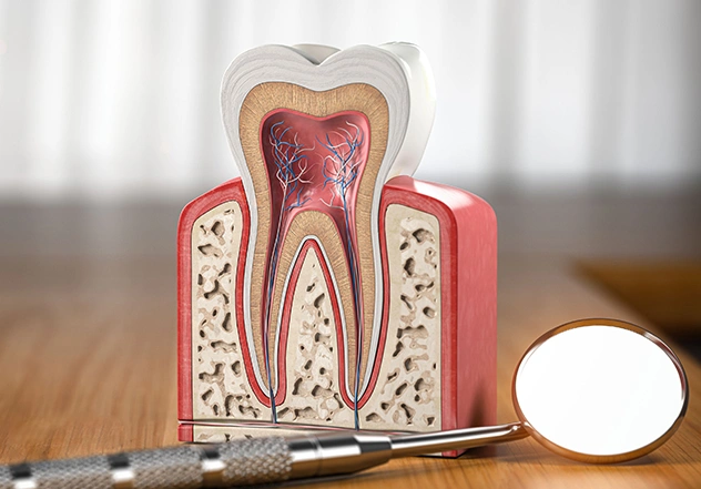 Root Canal Therapy Bedford