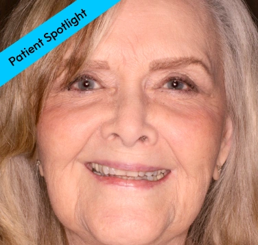 Patient Spotlight -  Before Smile Transformation 
