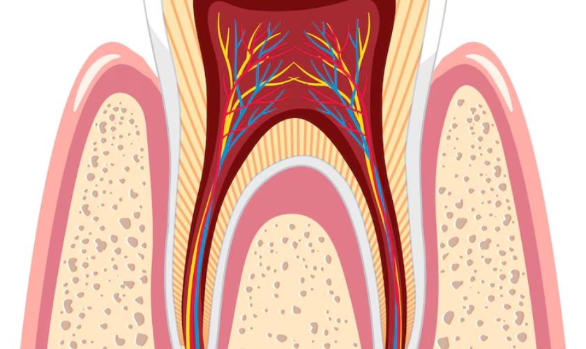 a tooth dead after a root canal