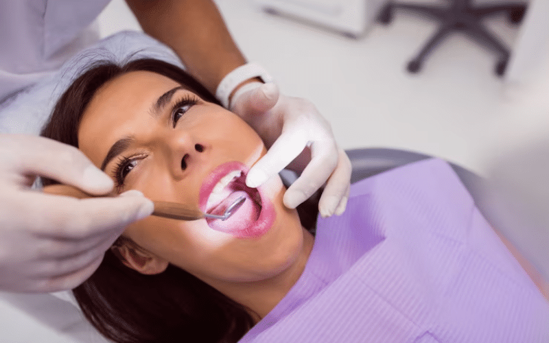 Say Goodbye to Stains: The Benefits of Professional Teeth Whitening