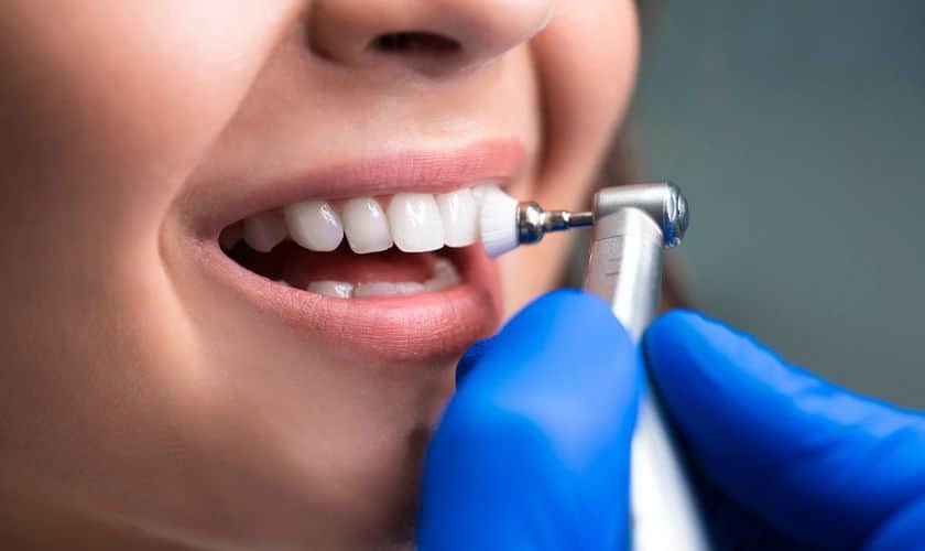 Why You Shouldn’t Skip Your Regular Fluoride Cleanings