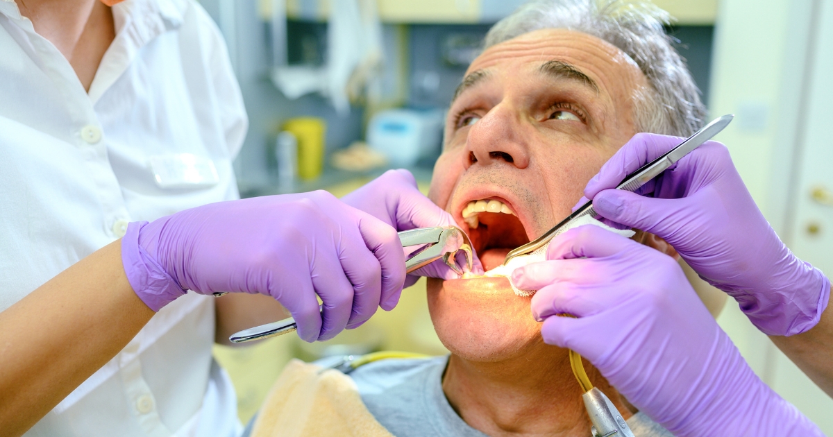 Top Reasons You Might Need a Tooth Extraction