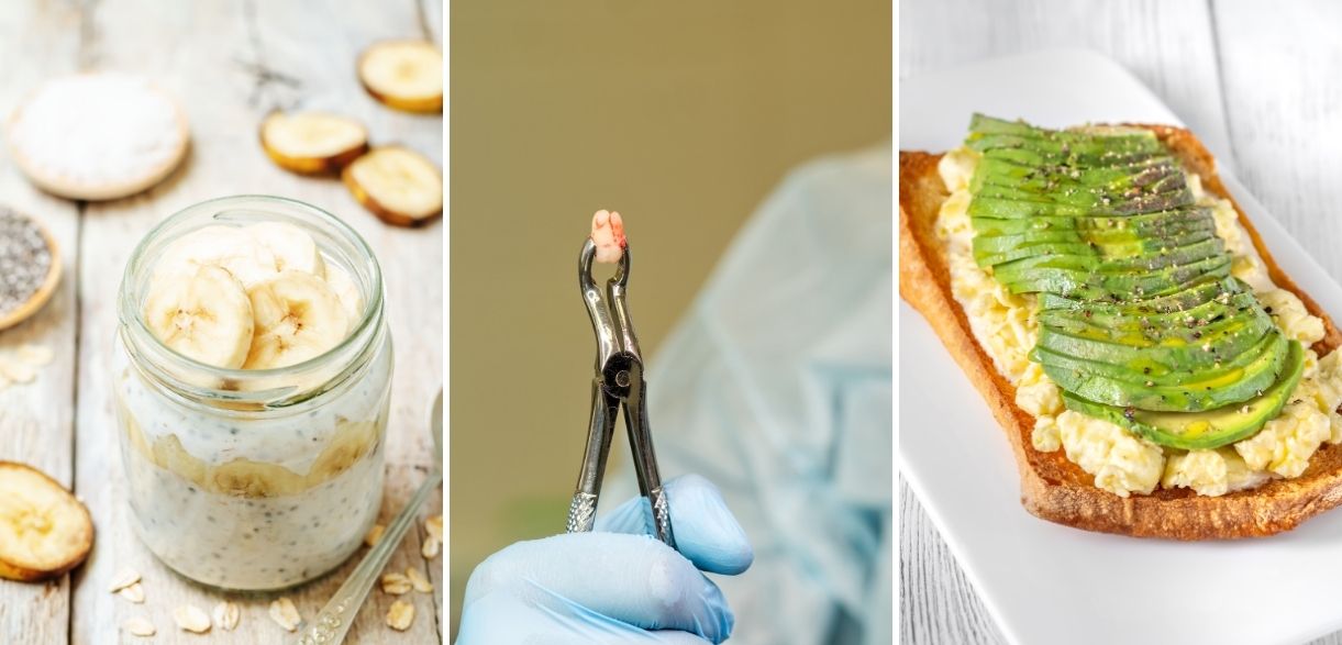 8 recipes for faster healing after wisdom teeth removal