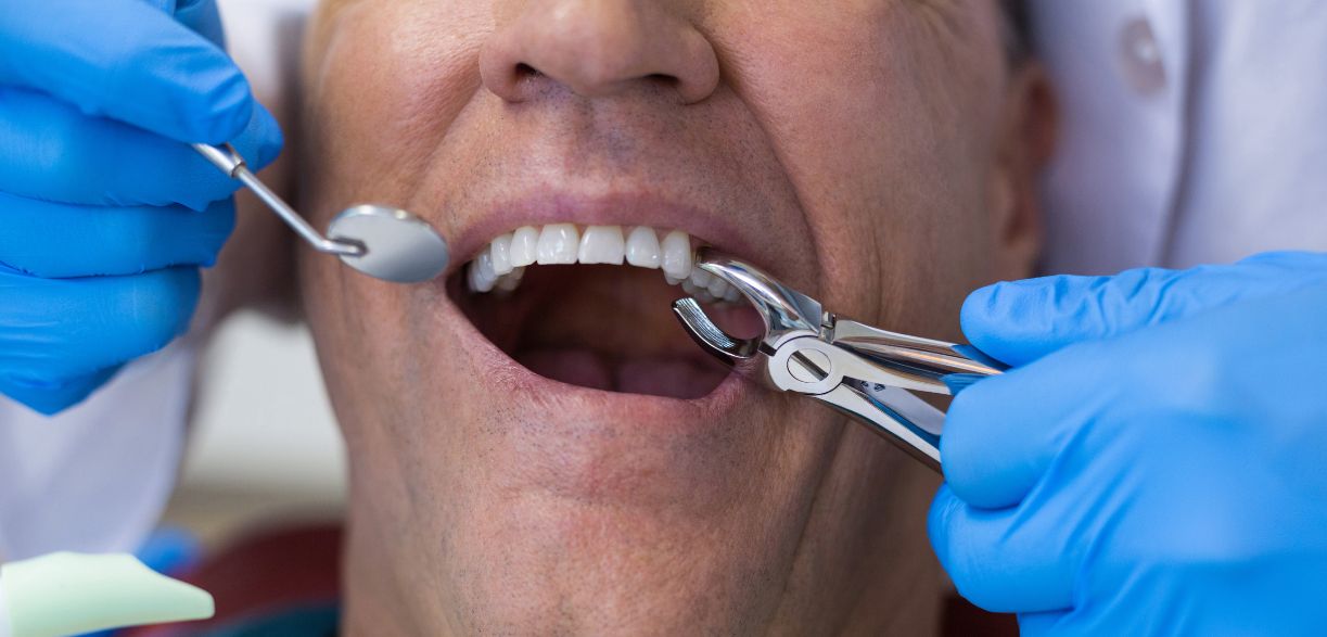 Ear Pain After Tooth Extraction