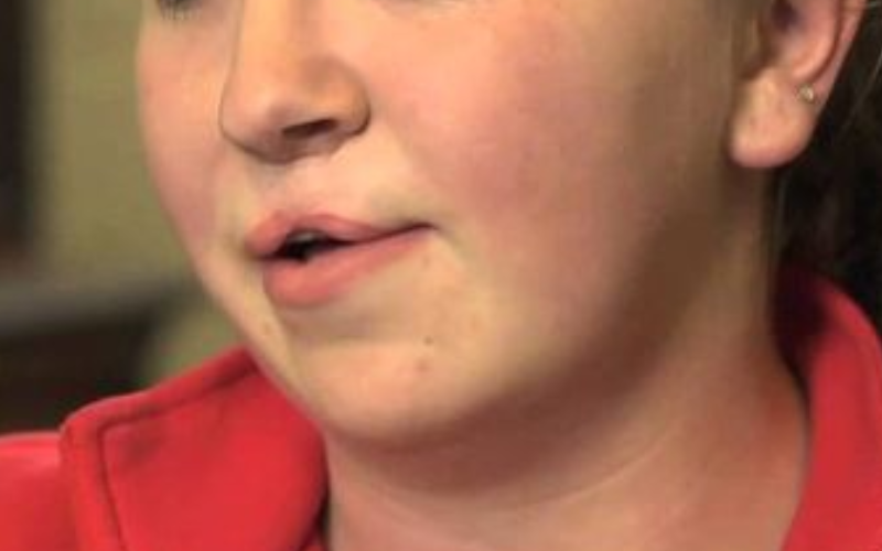 Cleft Lip and Palate Treatment