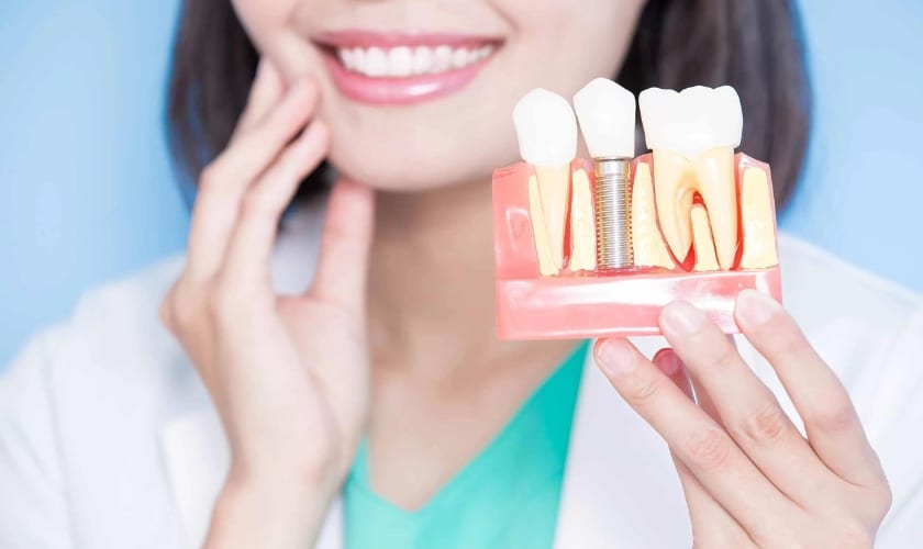 Dental Implants in Encino