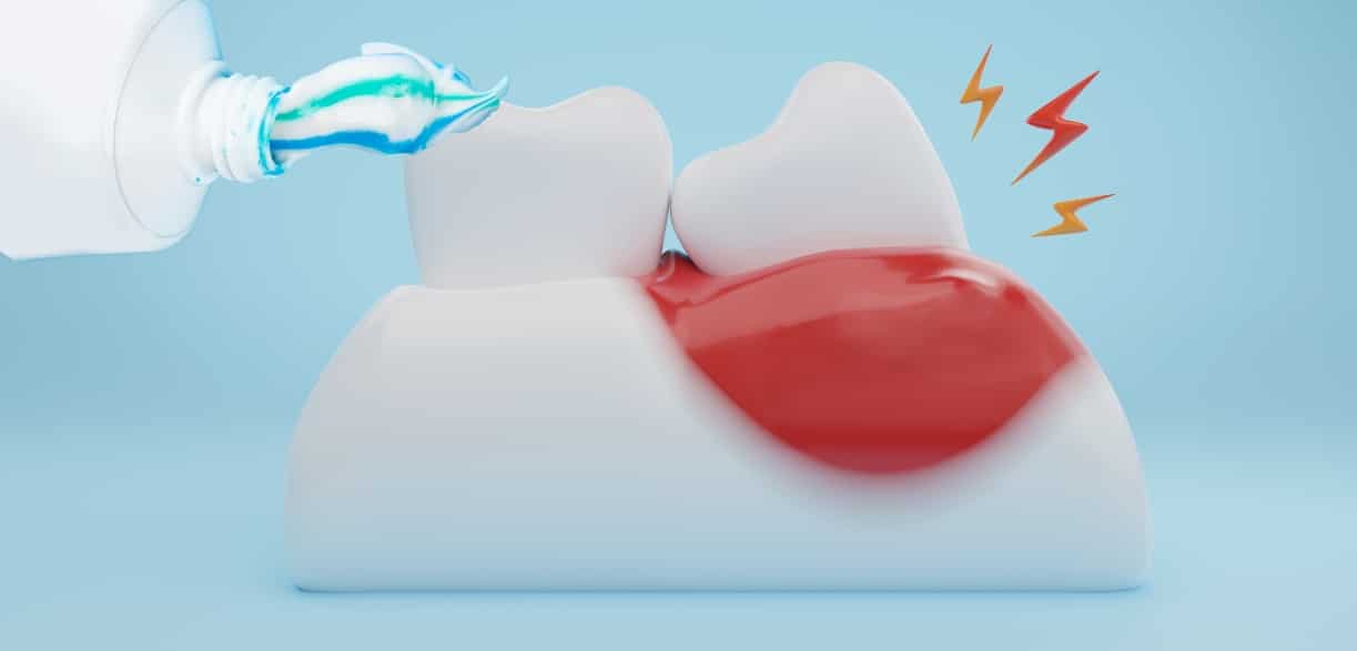 toothpastes for gingivitis and gum disease