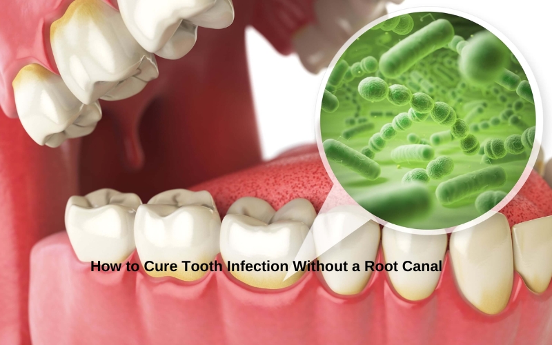 Natural Ways to Treat Tooth Infection and Avoid Root Canal