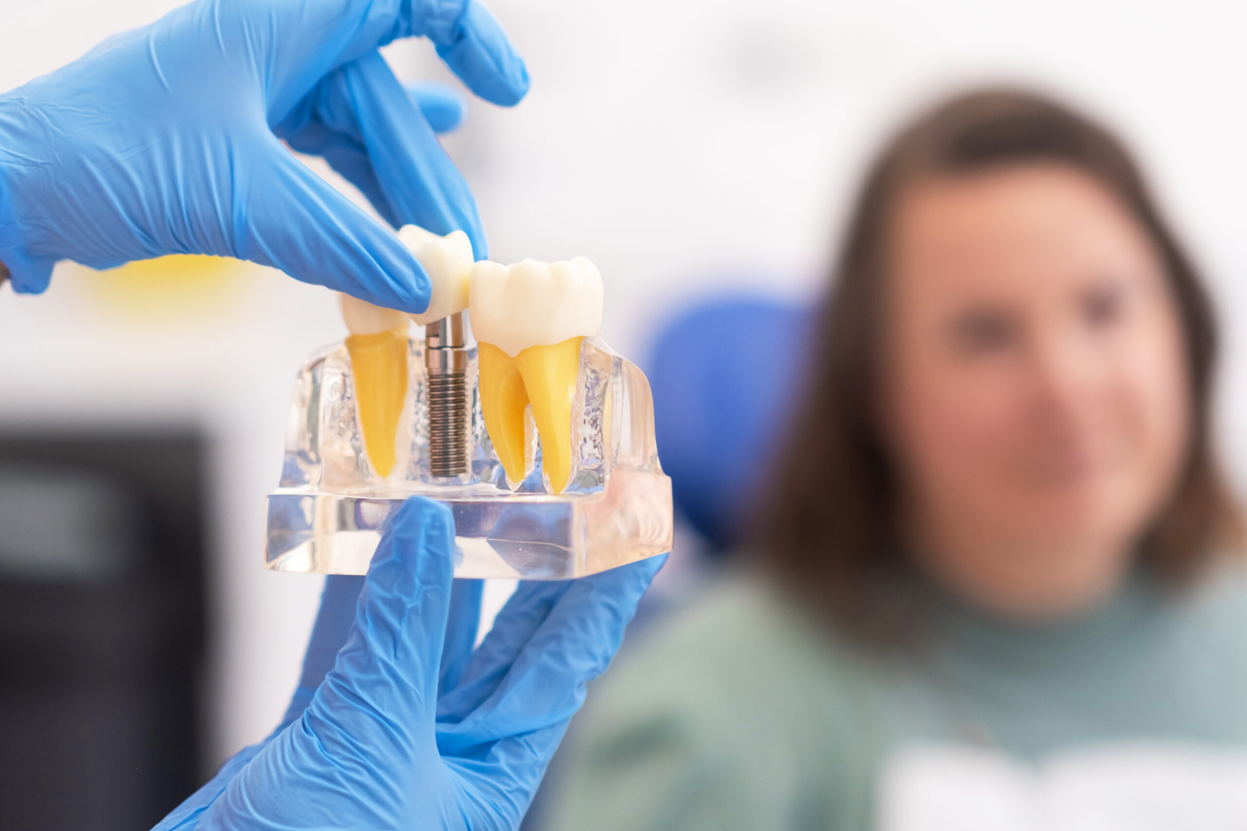 Dental Implants for Missing Teeth
