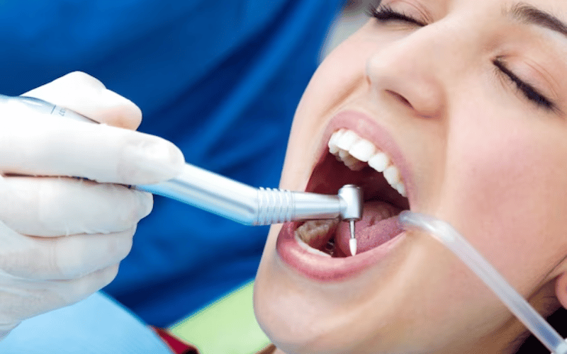 Tooth Restoration