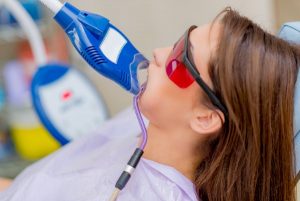 laser teeth whitening