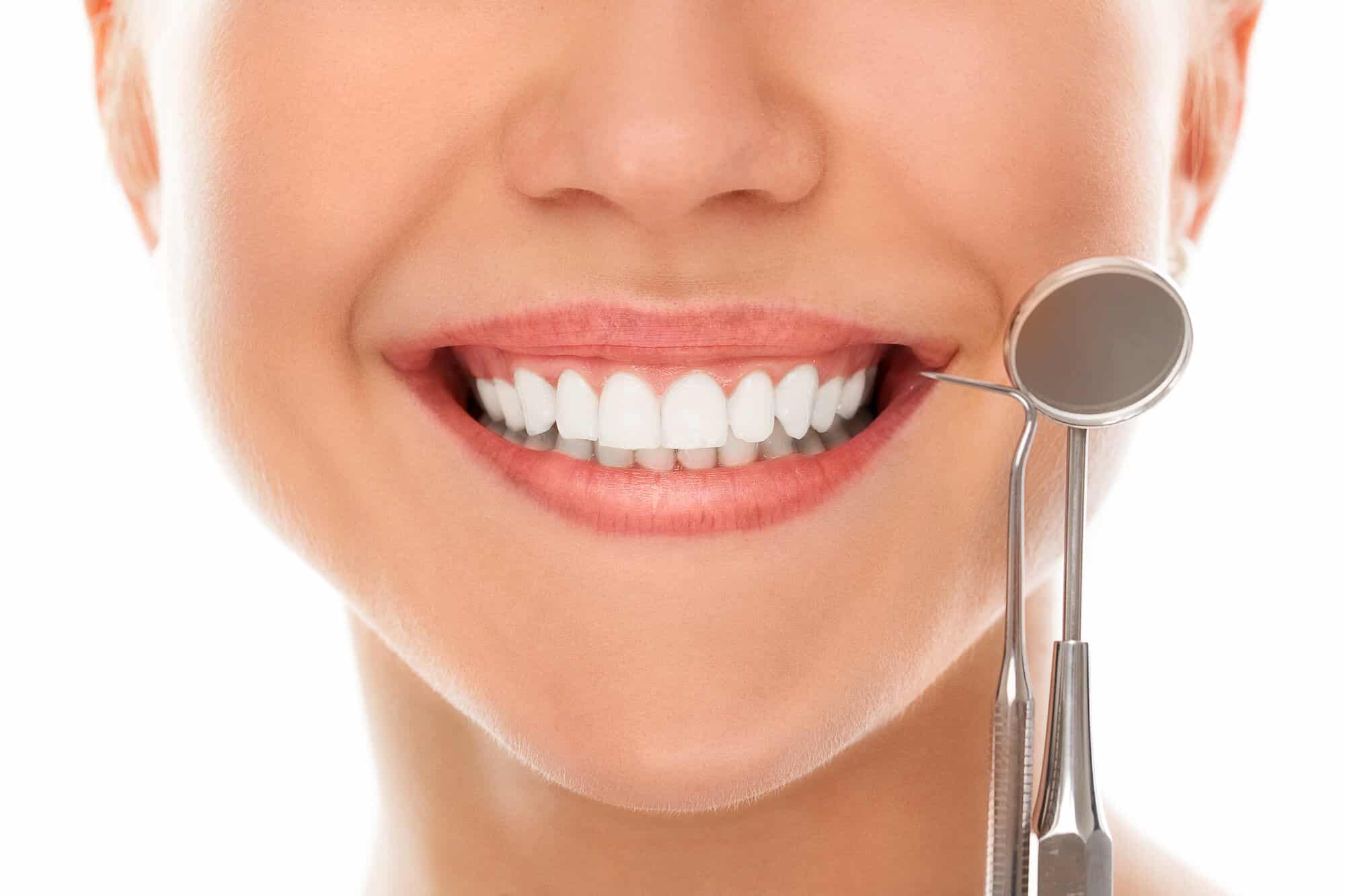 who offers the best veneers oak park?