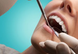 dentist checking mouth