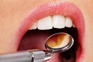 where is the best oak park dentist?