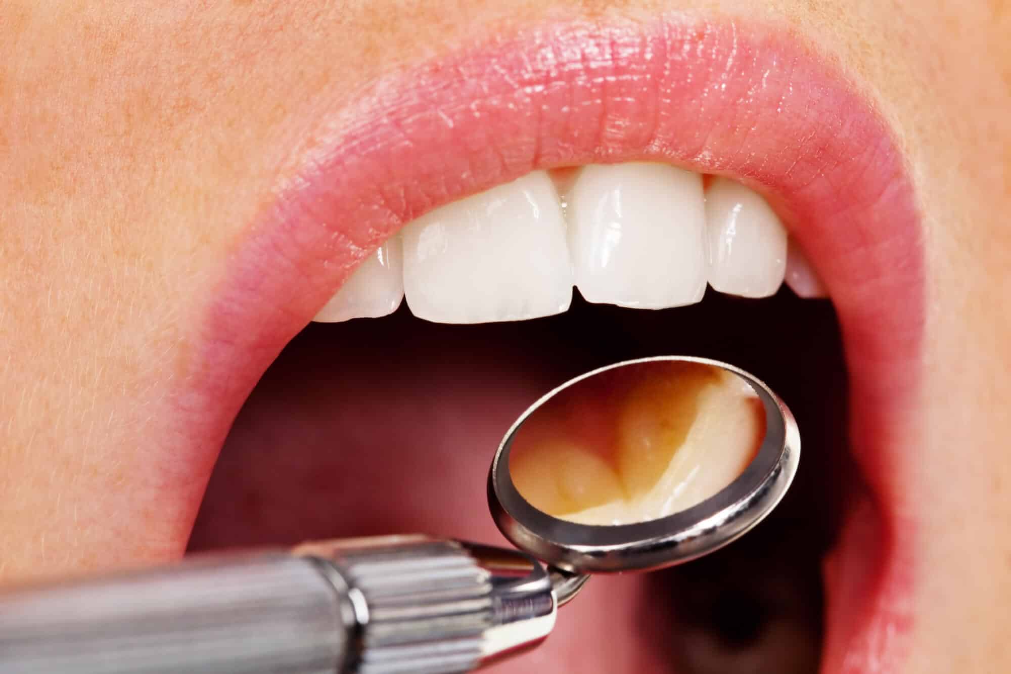 where is the best oak park dentist?
