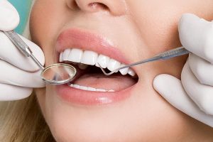 Where can I get Veneers Oak Park?