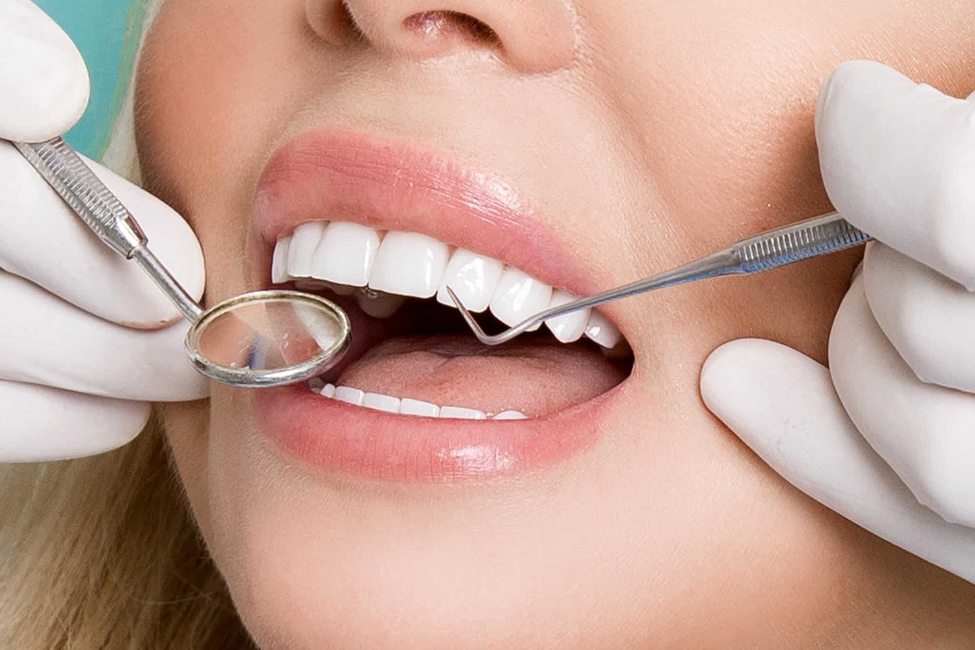 Where can I get Veneers Oak Park?