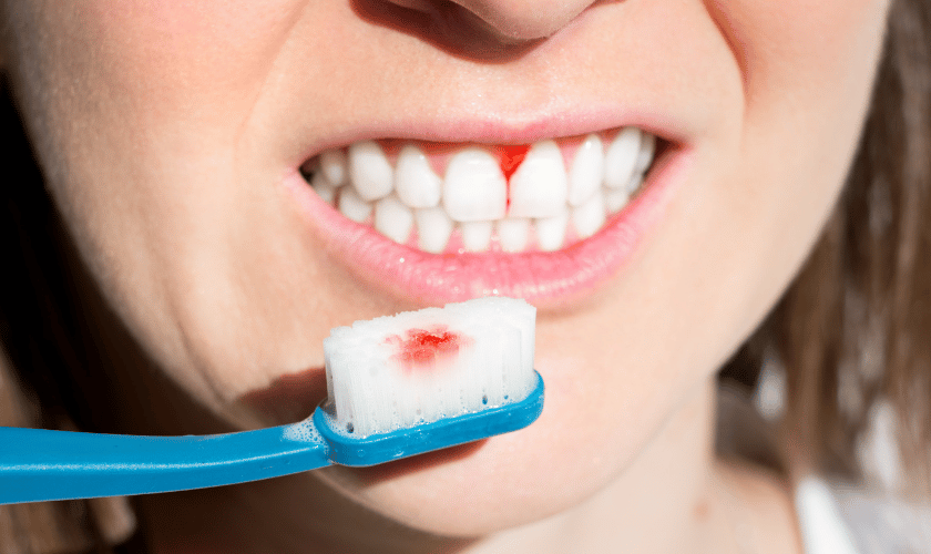Periodontal 4