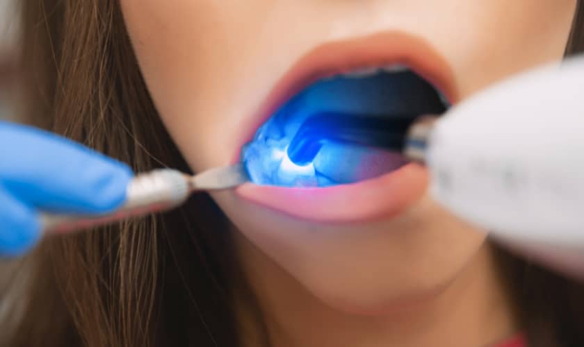 Restorative Dentistry in One Fine Smile - Dentist in Oak Park