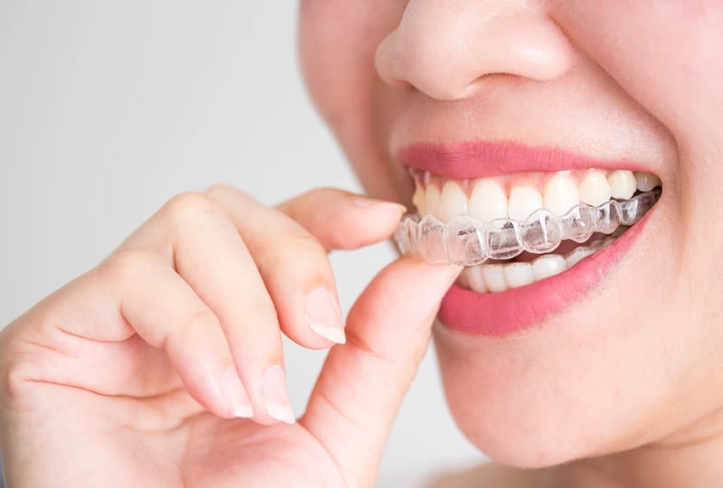 How Invisalign Can Improve Your Oral Health?