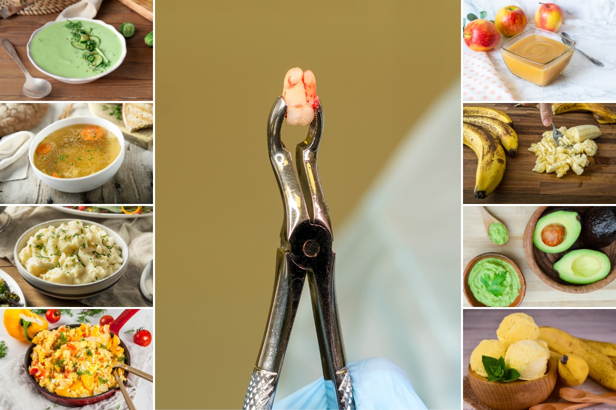 foods-to-eat-after-wisdom-teeth-removal