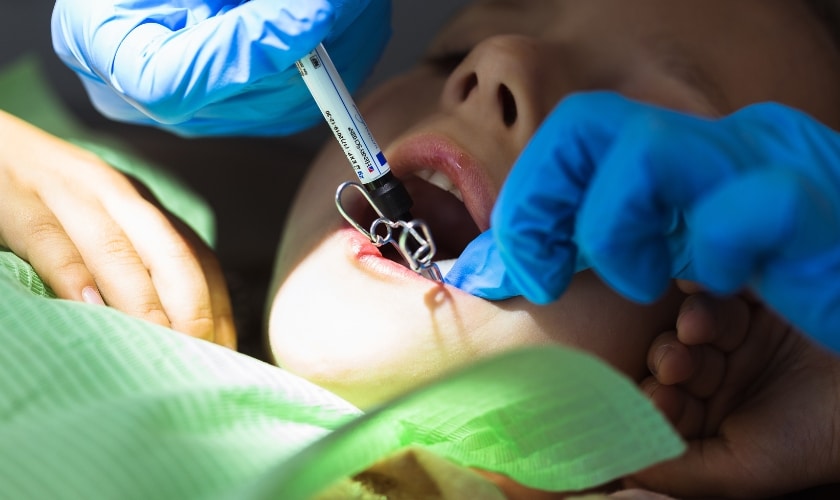 how long do dental fillings last