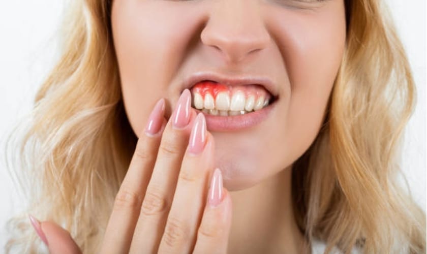 what are the benefits of gum surgery
