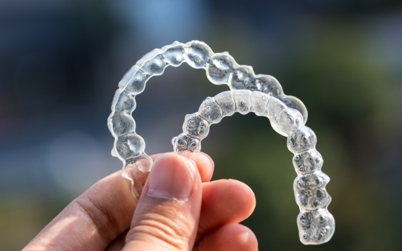 First Week With Invisalign