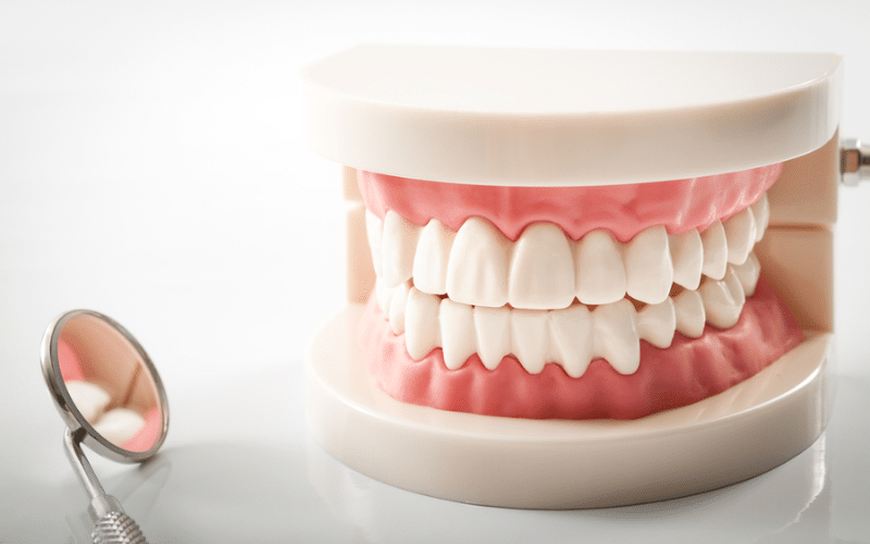 Health Conditions That Make You A Candidate For Complete Dentures
