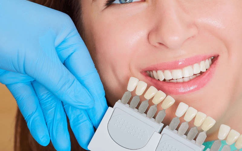 Why You Should Choose Porcelain Veneers