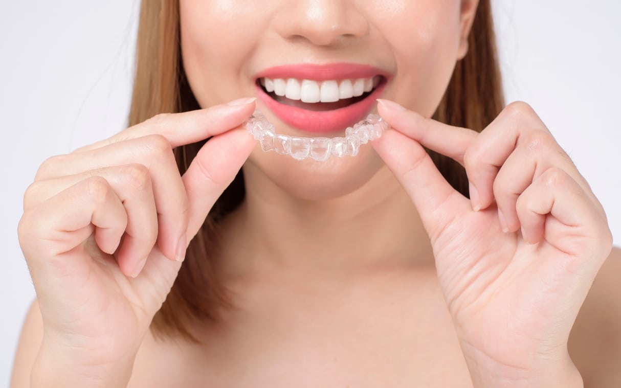 invisalign require maintenance
