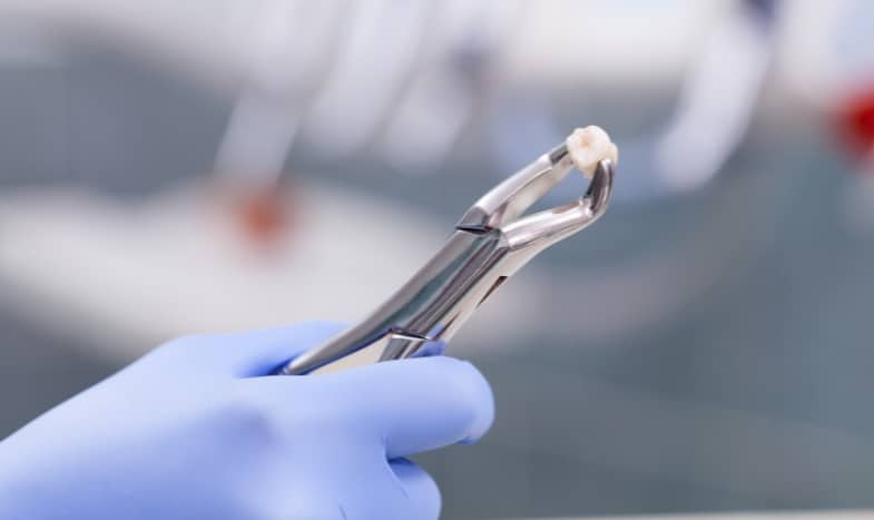 How To Tell If A Tooth Needs To Be Extracted
