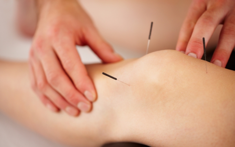 Featured image for “The Holistic Effects of Acupuncture Treatment”