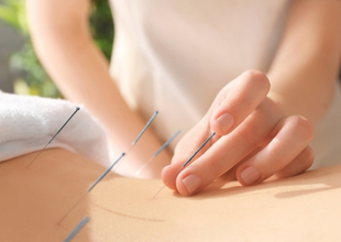 Featured image for “How Acupuncture Can Help Relieve Chronic Pain?”