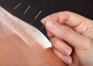 Featured image for “How Acupuncture Can Relieve Chronic Pain: A Natural Alternative to Painkillers”