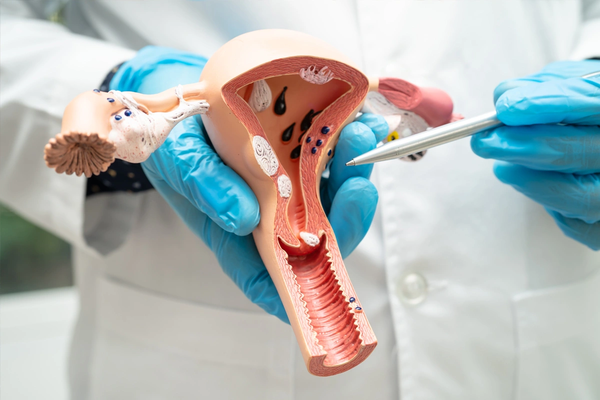 Featured image for “Urinary Tract Infections (UTIs): When to Visit Scotch Plains medical Center /Urgent Care”