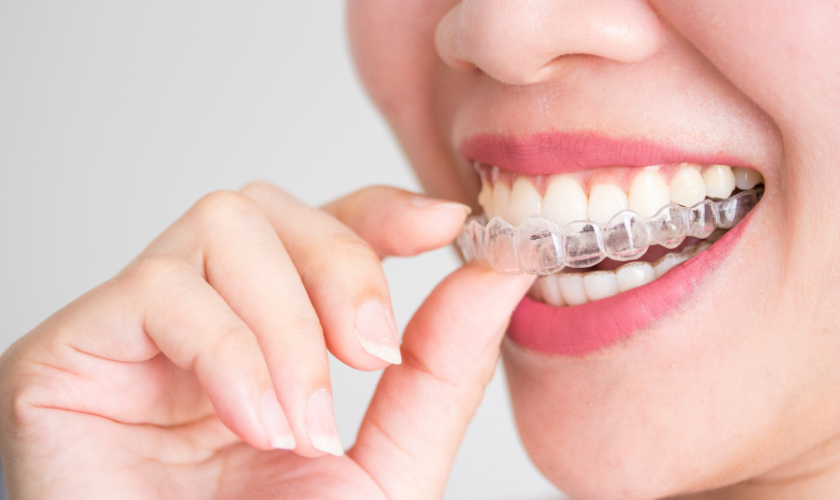 Invisalign in Colleyville TX, Serene Dental of Colleyville, Dentist, Dentist in Colleyville TX,