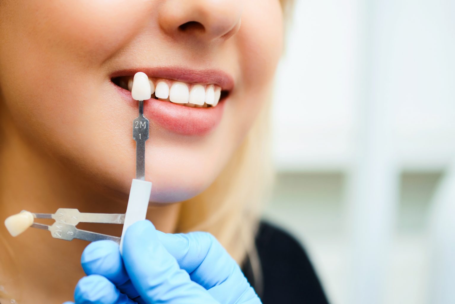 candidate for dental crowns colleyville tx