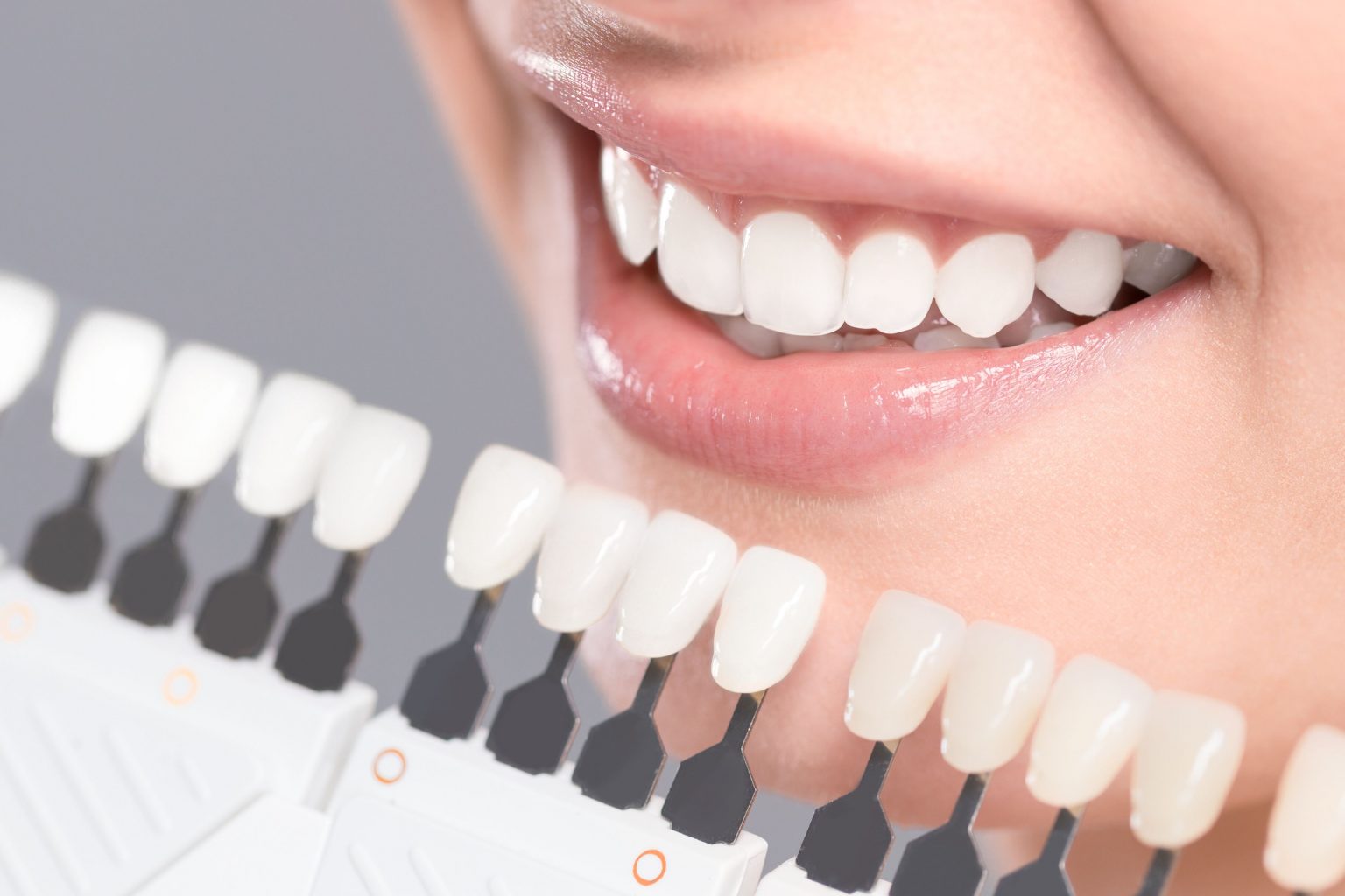 porcelain veneers procedure in colleyville tx