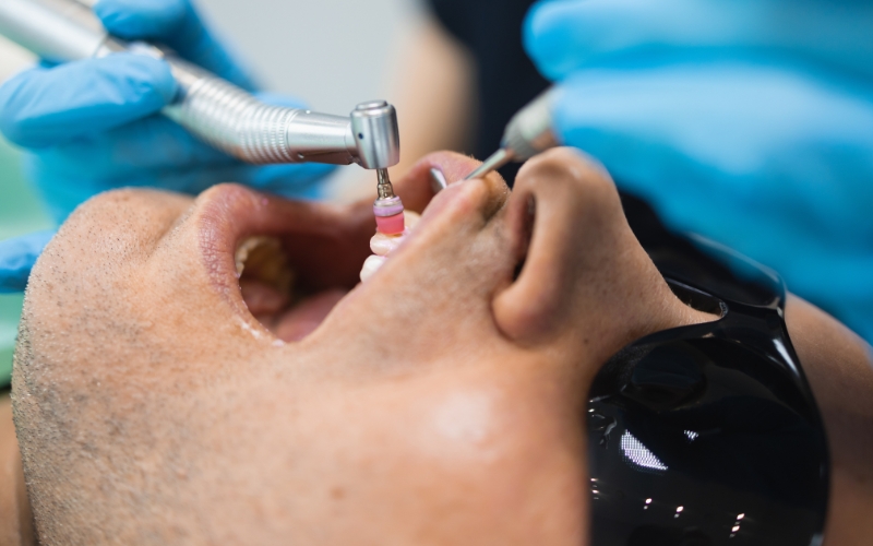 regular dental cleanings
