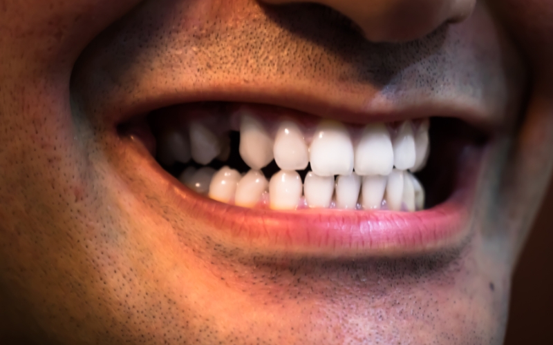 Exploring the Oral Microbiome