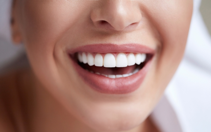 how does professional teeth whitening work