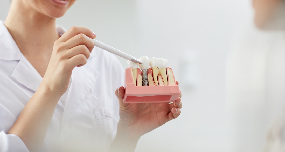 Can I Get A Dental Implant Years After Extraction