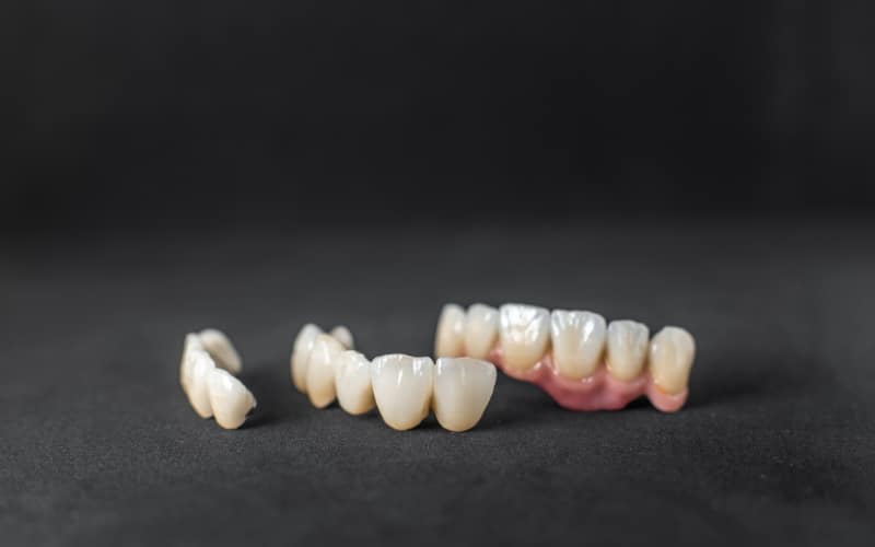 why you need dental crown