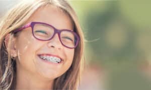 braces