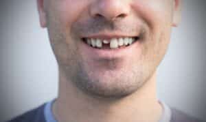 how to get a cracked tooth to stop hurting