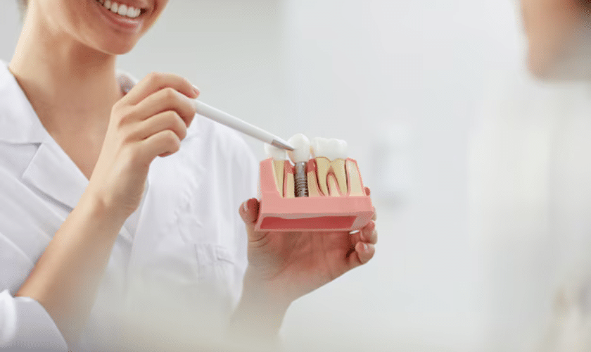 Preparing for Dental Implants- Steps and Considerations